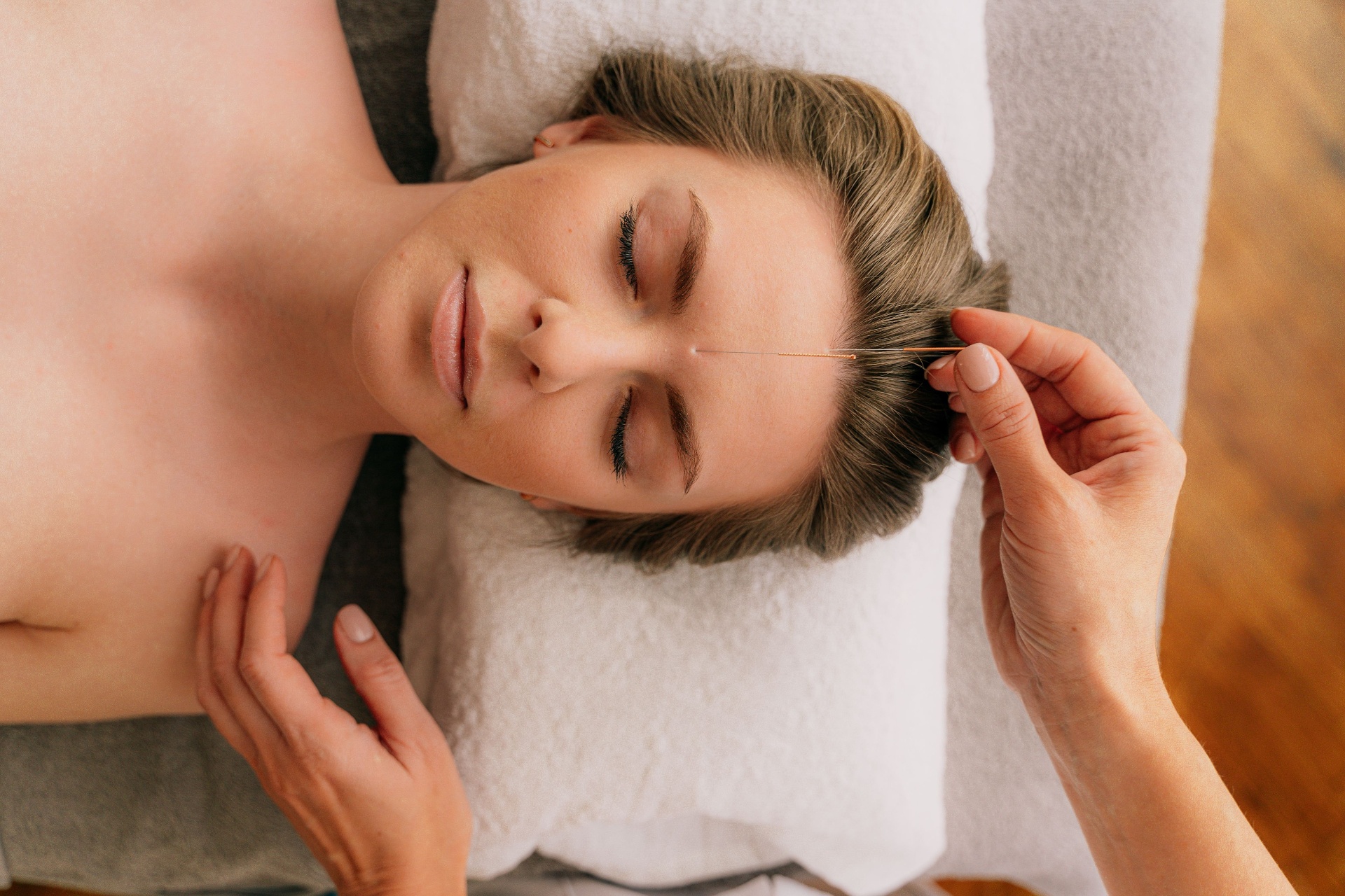 Acupuntura facial estética na Clínica Estrela Dalva