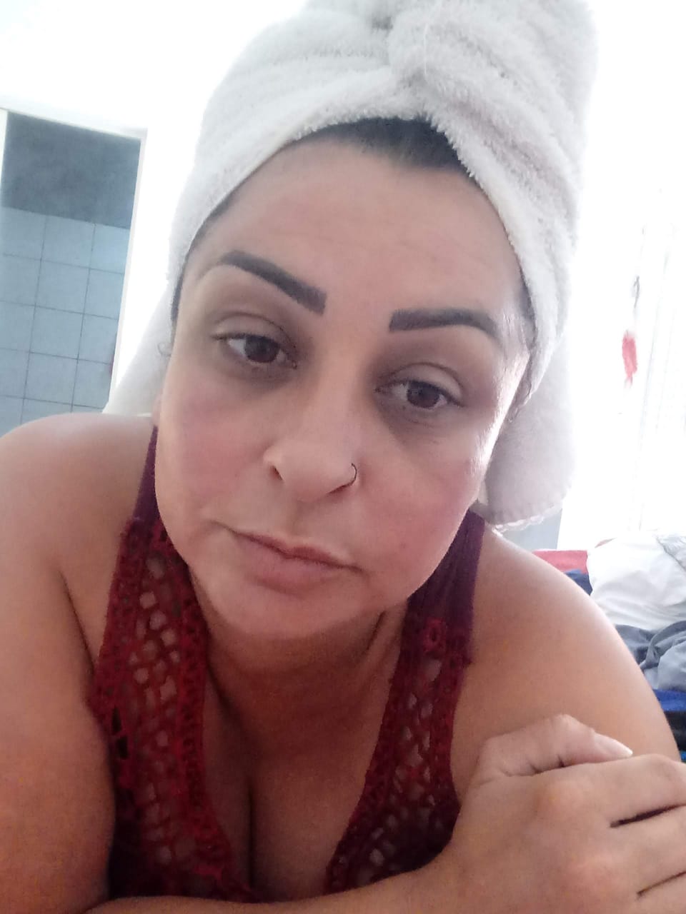 Depois – Peeling para Manchas e Melasma